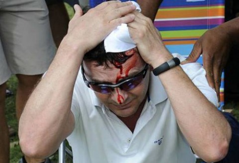 Tiger Woods đánh bóng vỡ đầu khán giả